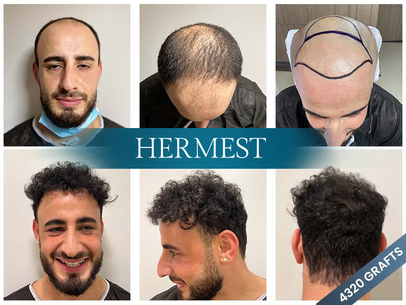 Hermest Clinic
